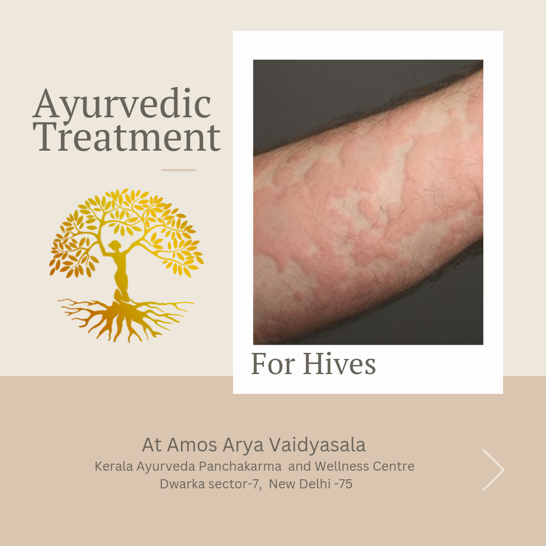 Treatment for allergy in ayurveda